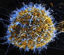 Ebola Virus Particles ansicht killer Afrika Amerika Forschung Todmacher Krankmacher