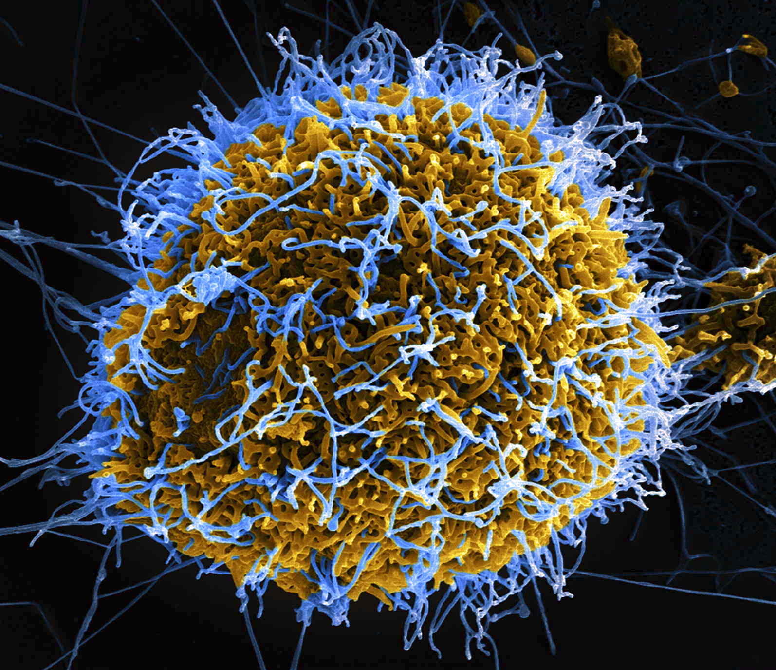 Ebola_Virus_Particles_ansicht_killer_Afrika_Amerika_Forschung_Todmacher_Krankmacher