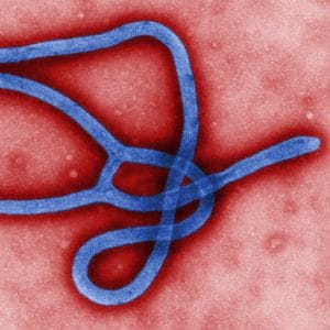 Ebola künftig per Telefon, Internet und TV übertragbar angeblicher Ebola Erreger Krankheit Virus Ansteckung Gefahr toedlich Pandemie