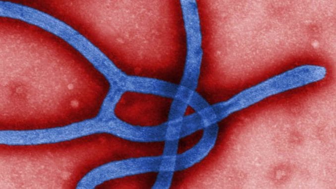 angeblicher Ebola Erreger Krankheit Virus Ansteckung Gefahr toedlich Pandemie